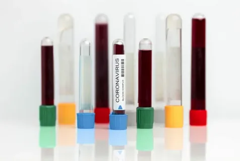 تصویر 3 از کیت آیمایش خون مخفی در مدفوع استریلیزه شده و با کیفیت